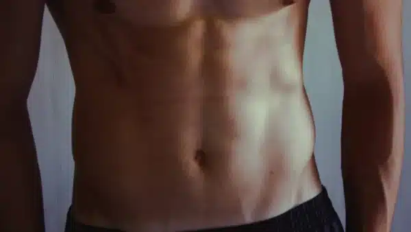 enfermedad inflamatoria intestinal