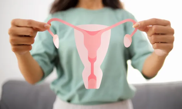cambia de nombre síndrome de ovario poliquístico