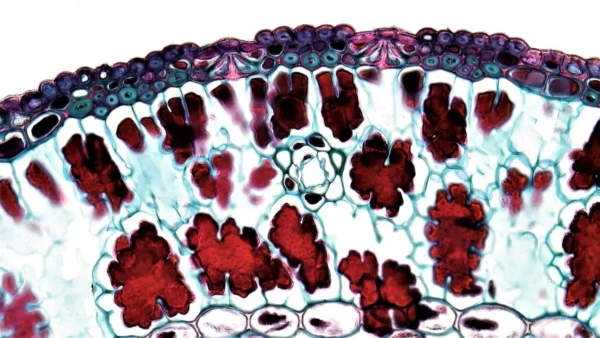 células cancerosas