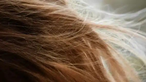 ¿Se te está cayendo el pelo por estrés? Estas son las señales que pueden revelarlo