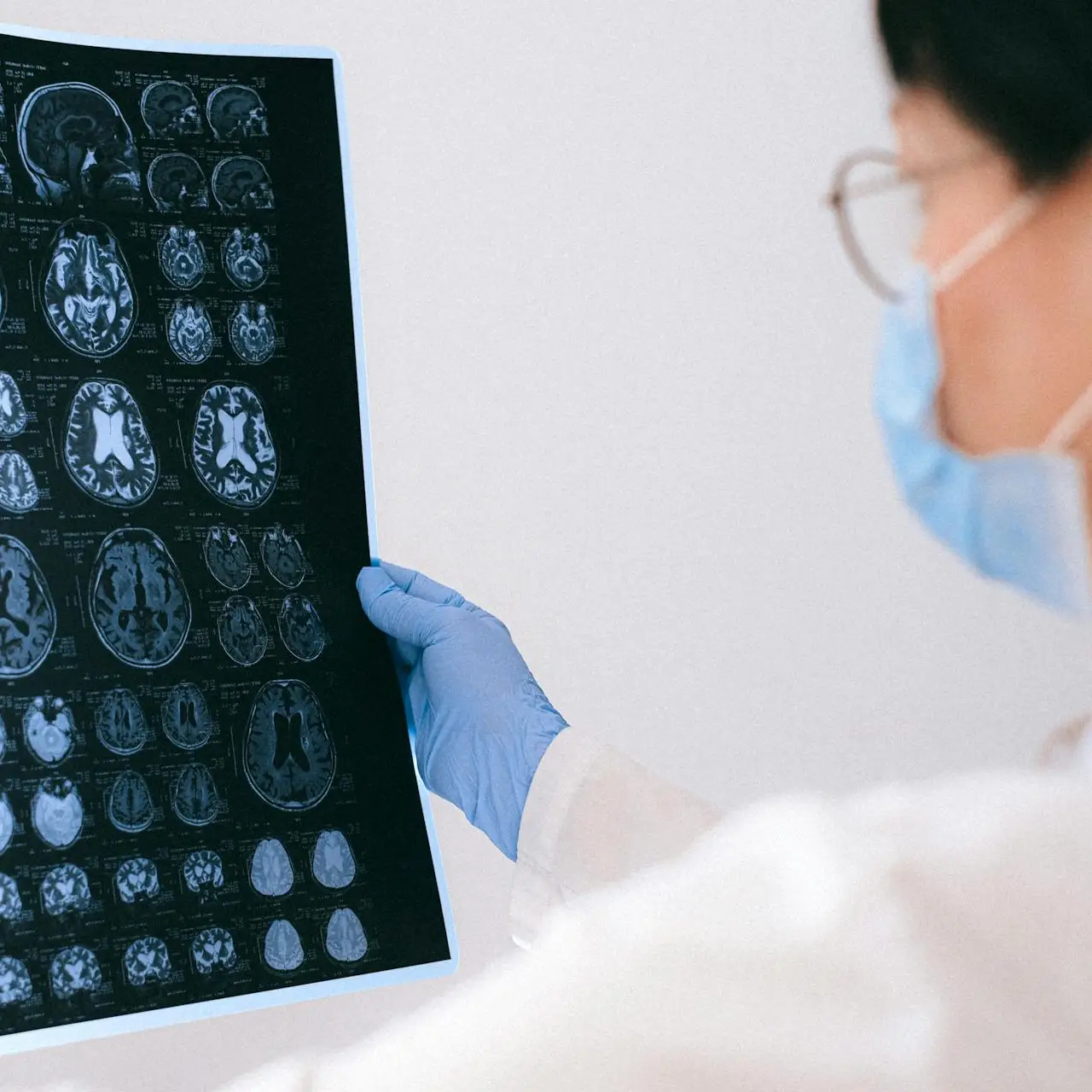 Desarrollan herramienta que predice el riesgo de Alzheimer con antelación - Guia de Bienestar